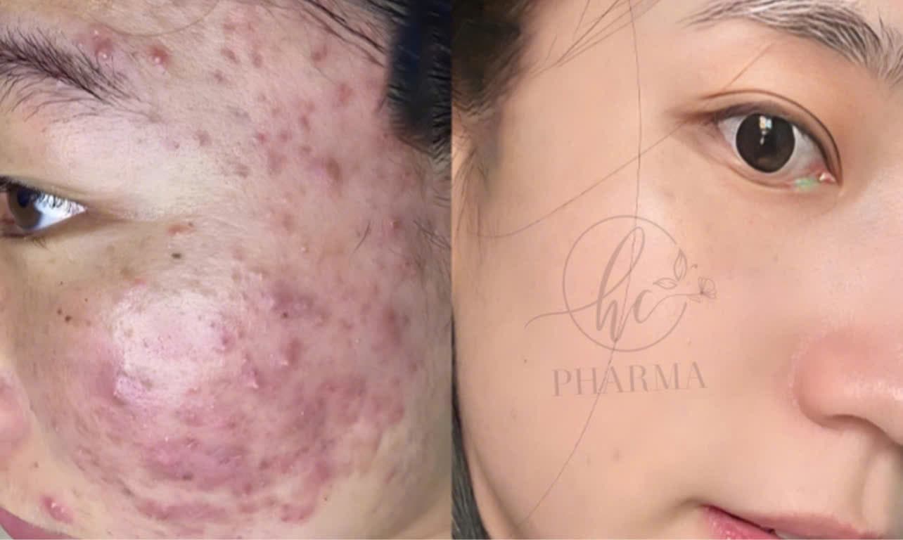 Hình ảnh kết quả 146