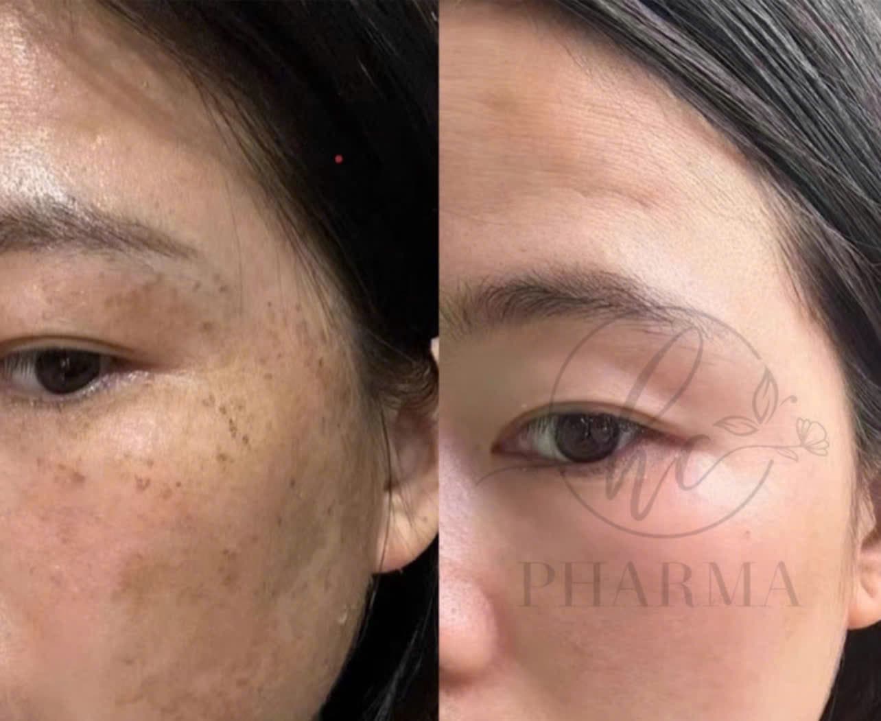 Hình ảnh kết quả 148