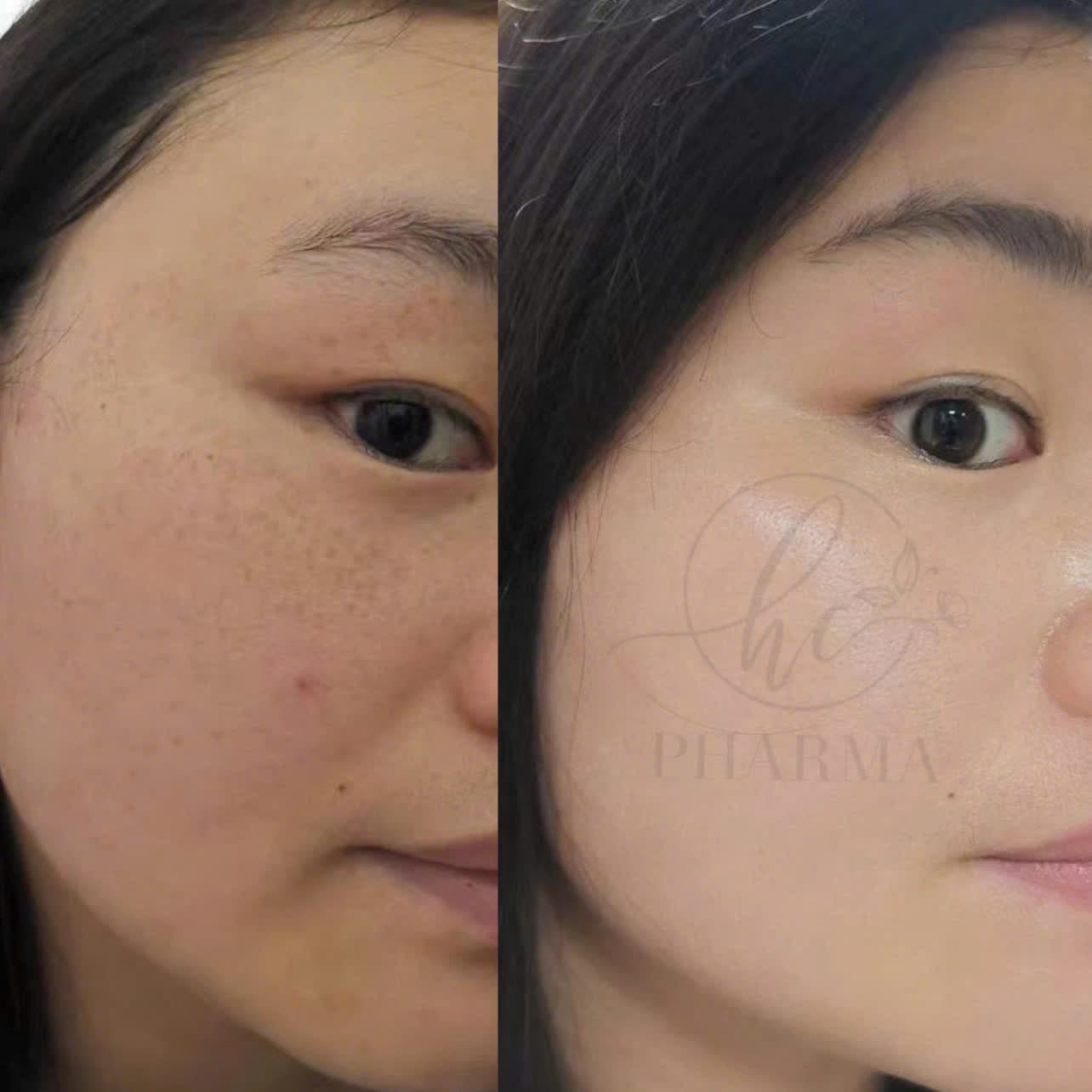 Hình ảnh kết quả 149
