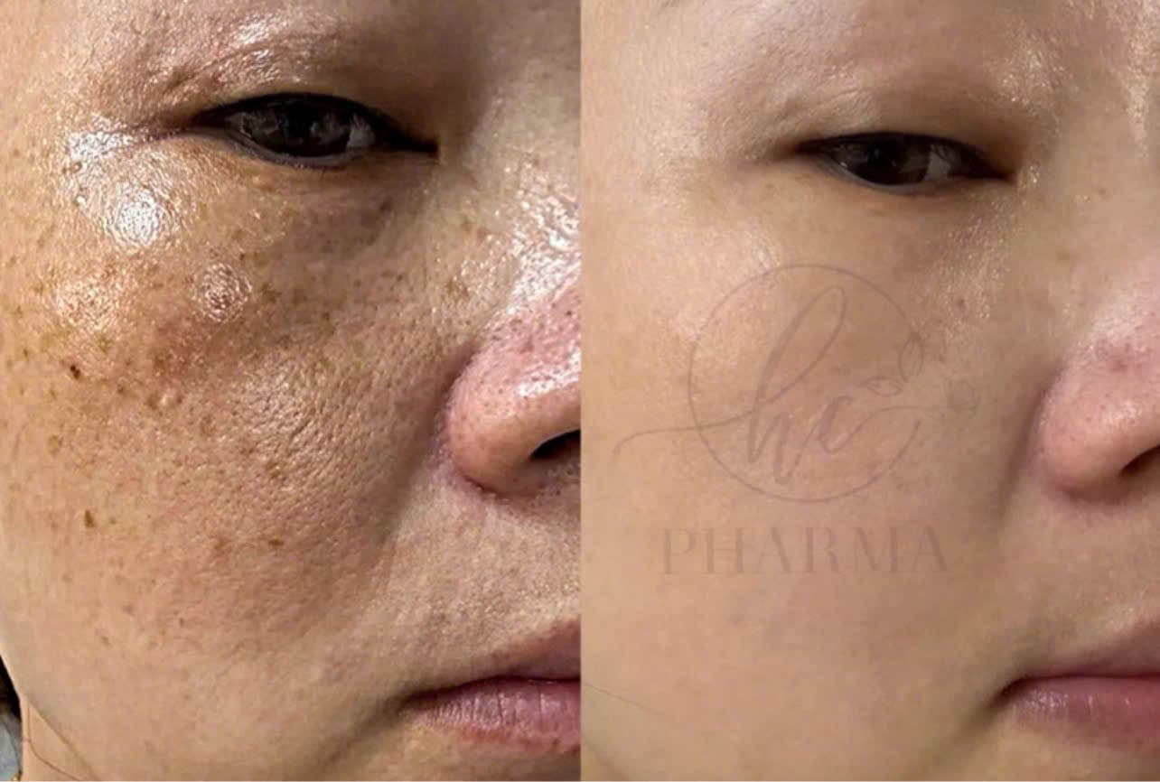 Hình ảnh kết quả 151