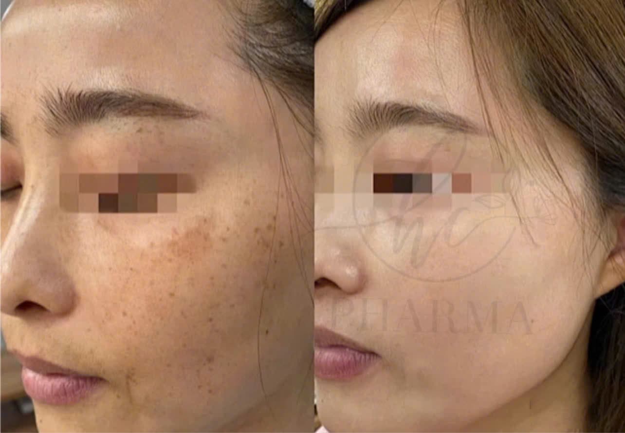 Hình ảnh kết quả 152