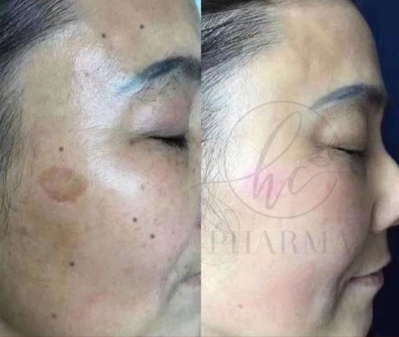 Hình ảnh kết quả 153