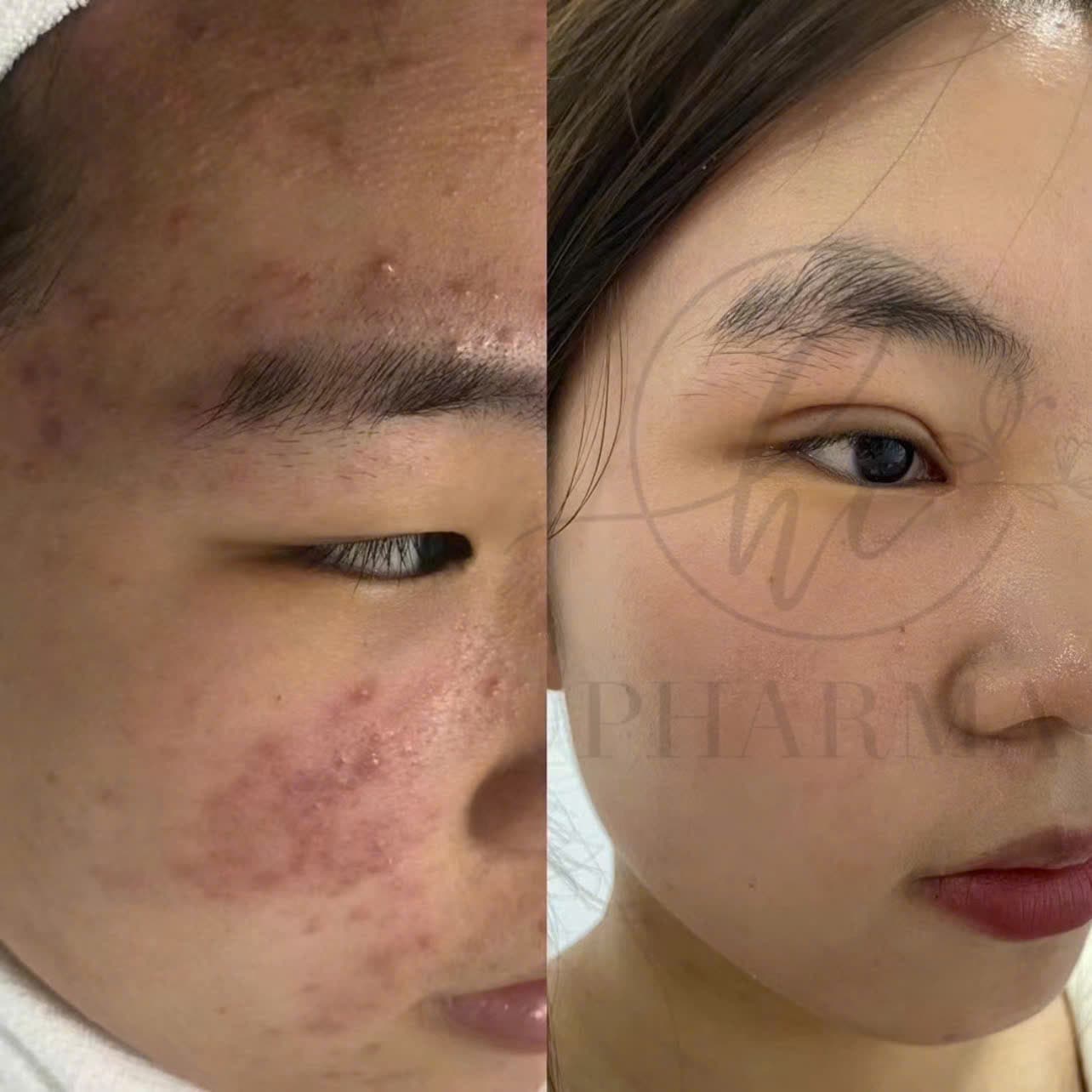Hình ảnh kết quả 156