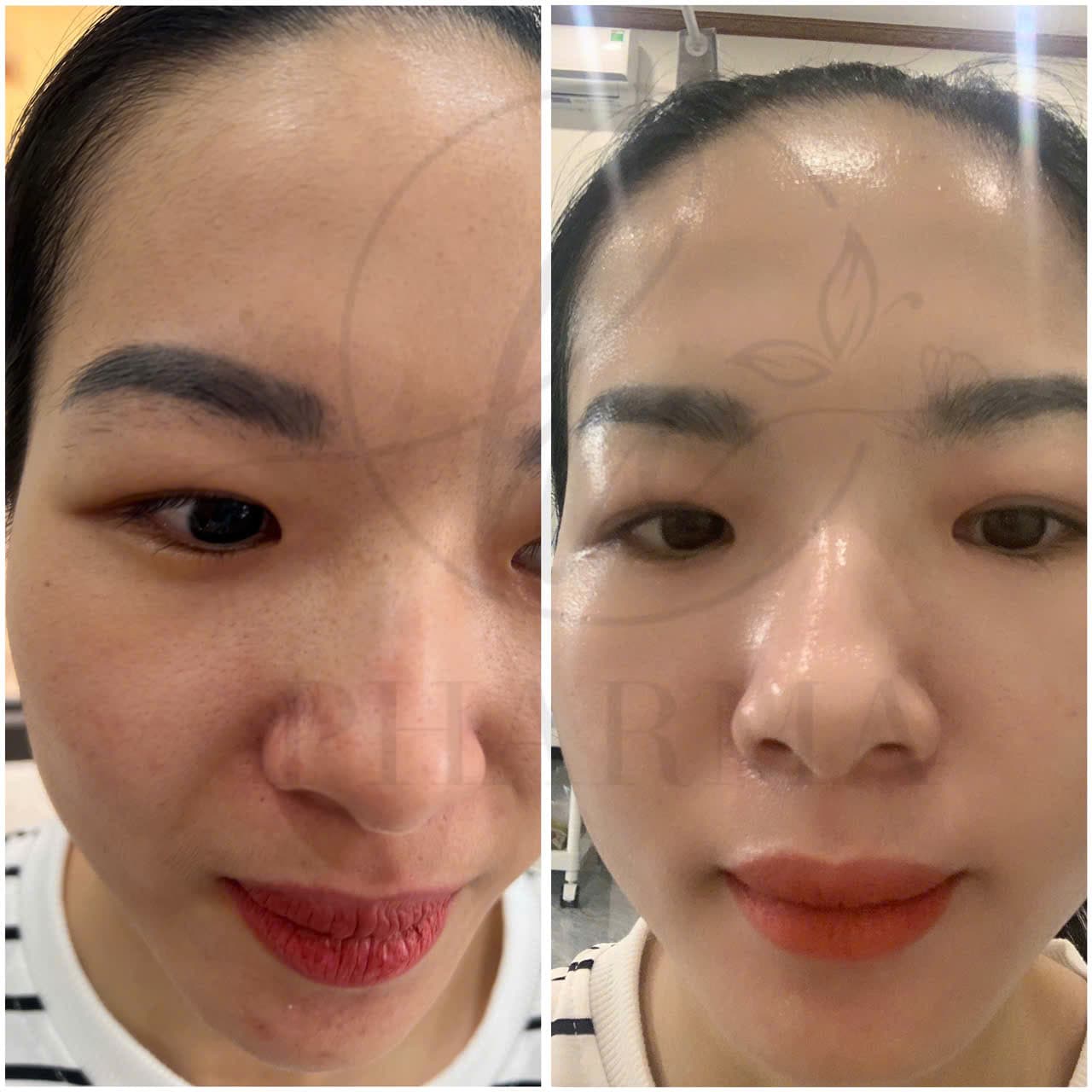 Hình ảnh kết quả 157