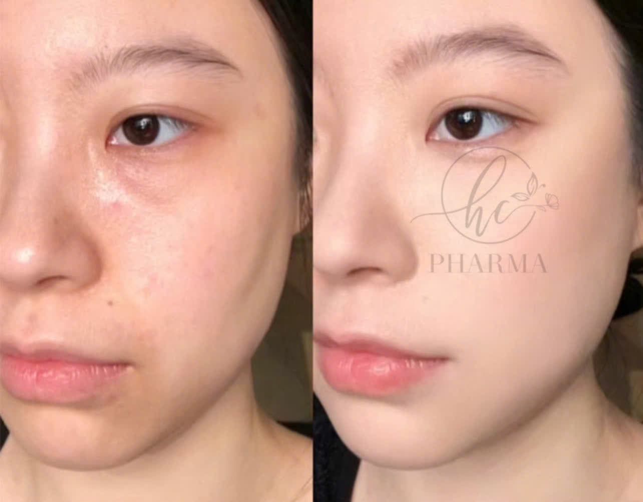 Hình ảnh kết quả 159