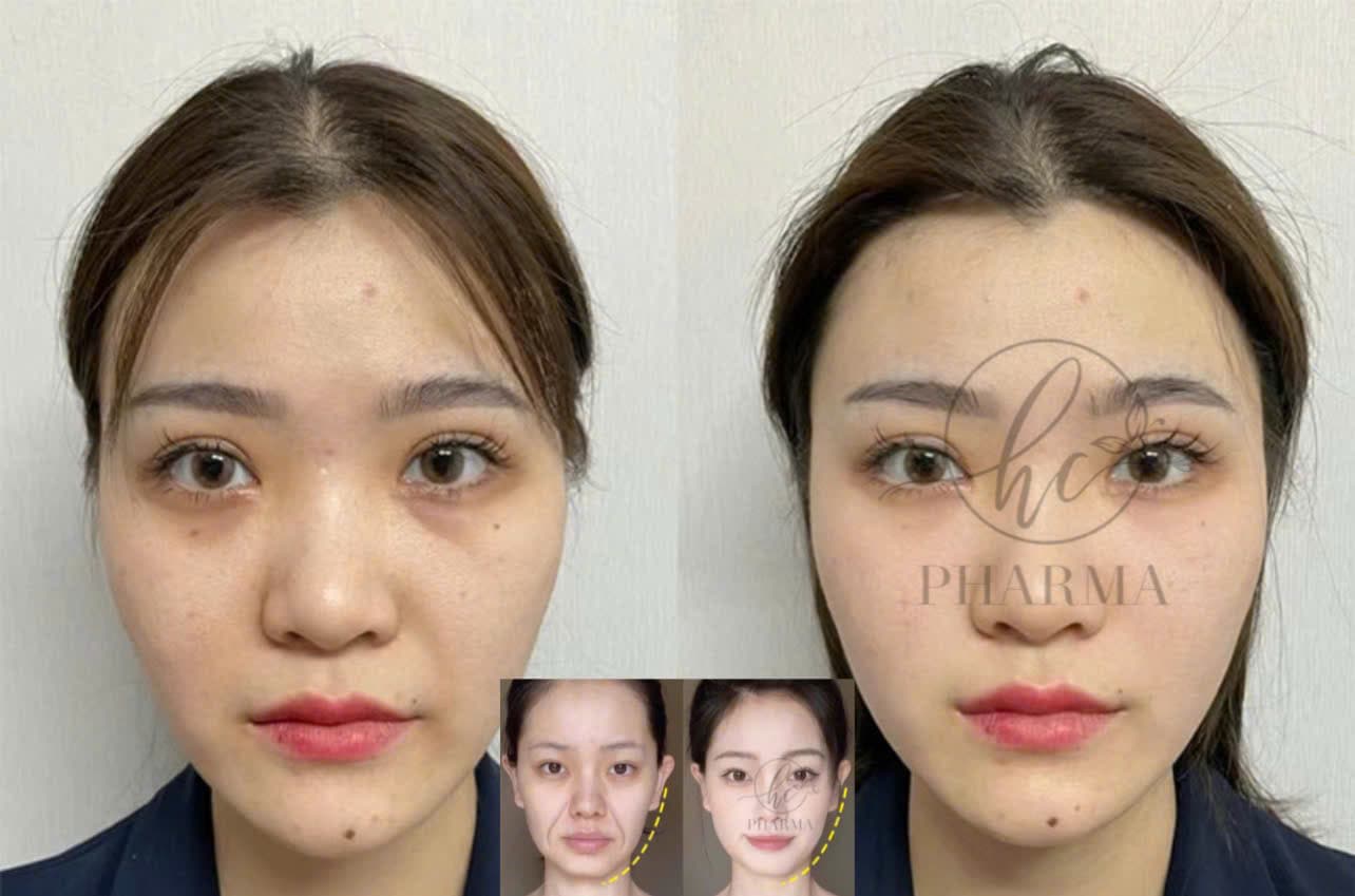 Hình ảnh kết quả 160