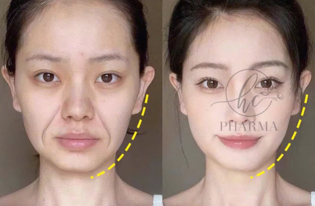 Hình ảnh kết quả 162