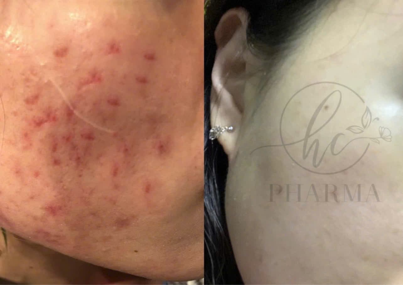 Hình ảnh kết quả 163