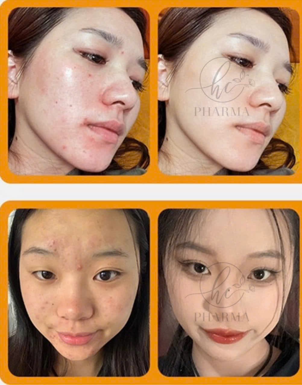 Hình ảnh kết quả 165