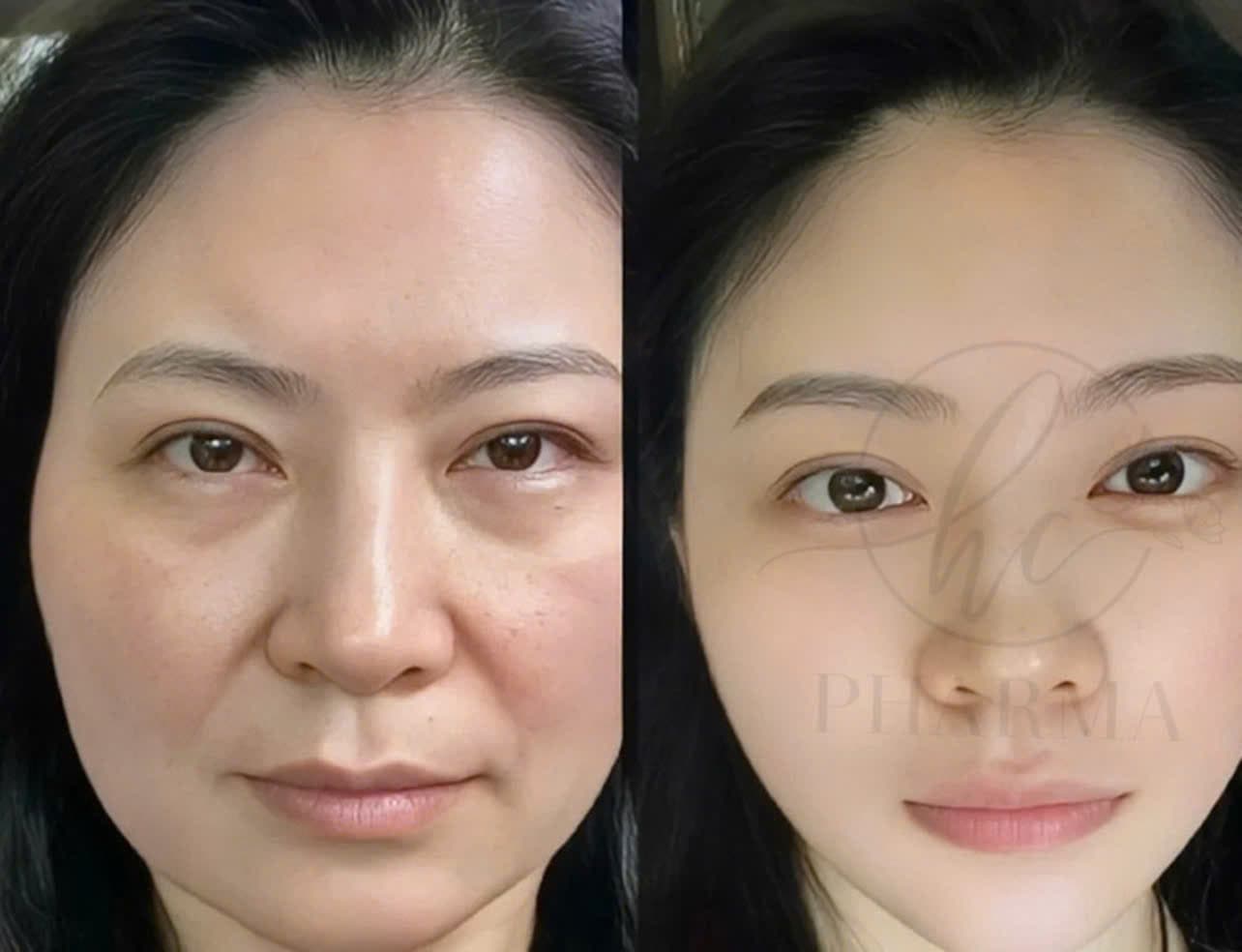 Hình ảnh kết quả 168