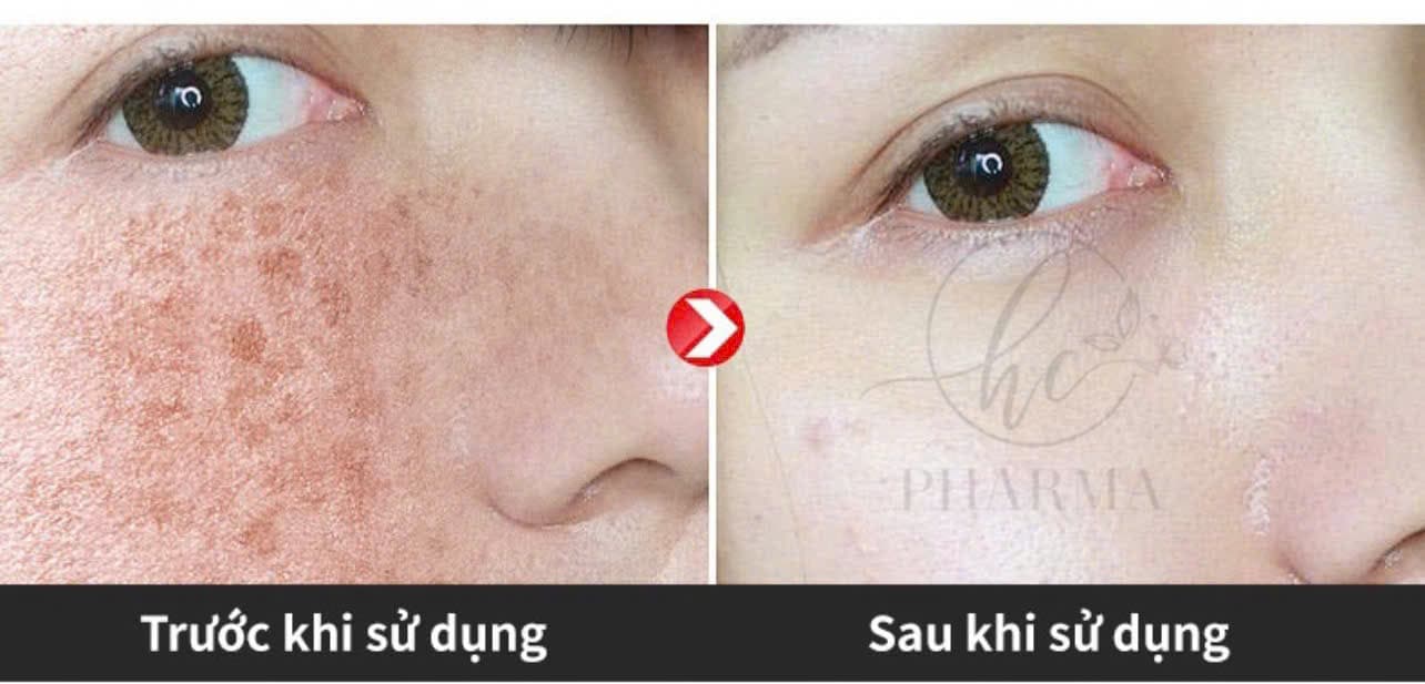 Hình ảnh kết quả 169