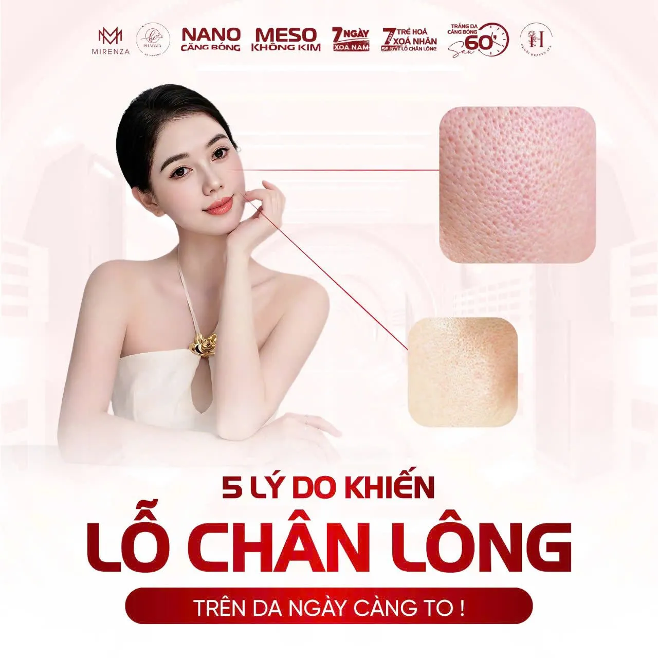Poster kiến thức chăm sóc da về lỗ chân lông to của HC Pharma