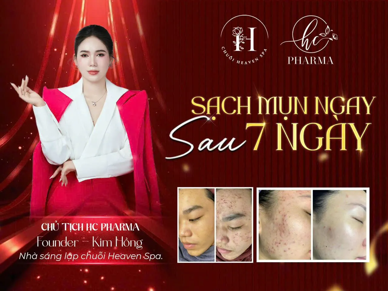 Poster giải pháp chăm sóc da mụn với hình ảnh da trước và sau
