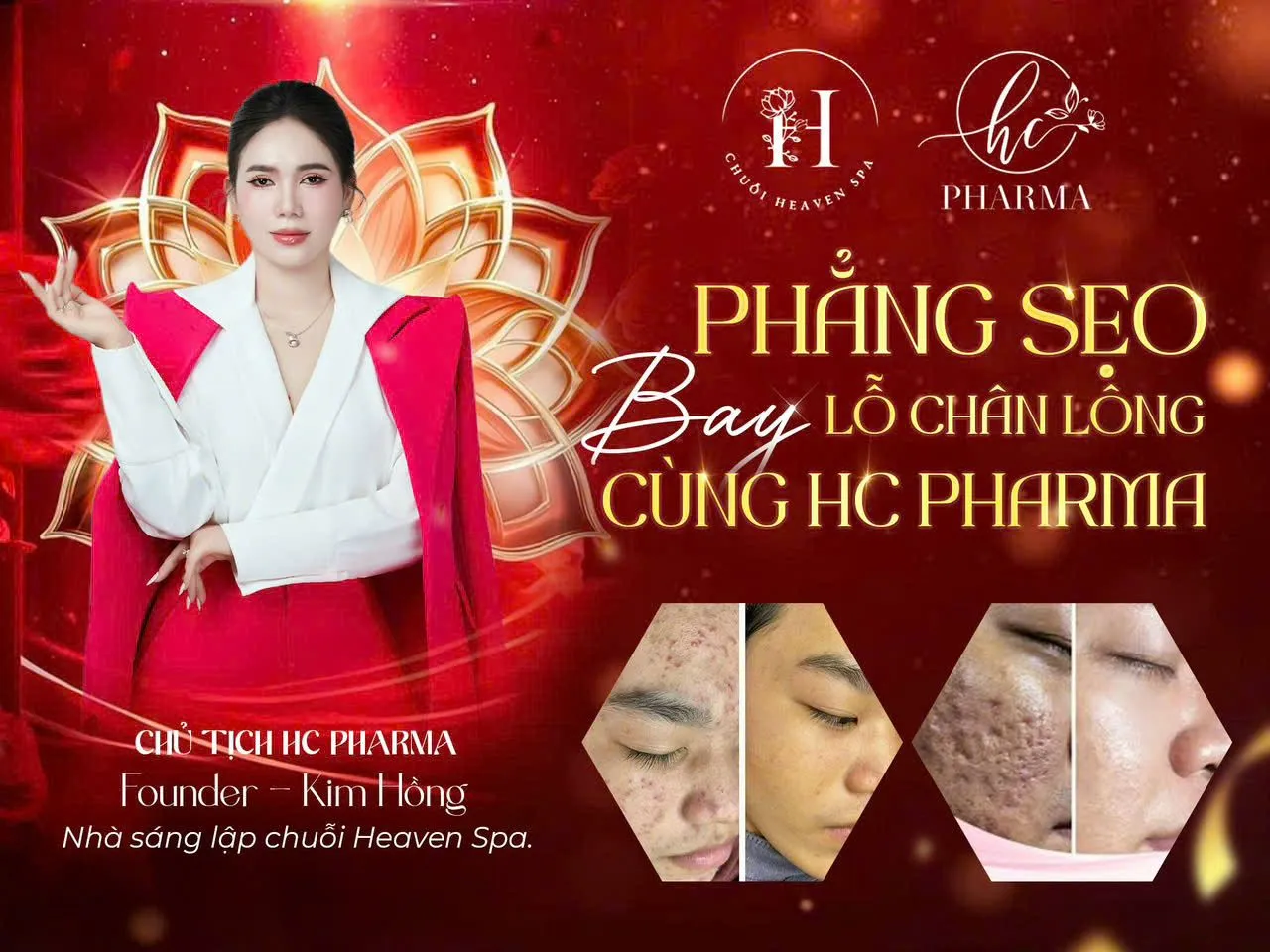 Poster giải pháp chăm sóc sẹo và lỗ chân lông của HC Pharma