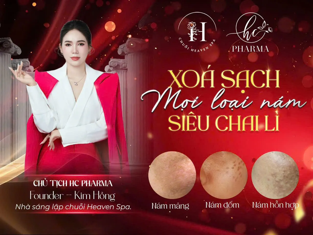 Poster phân loại nám mảng, nám đốm, nám hỗn hợp của HC Pharma