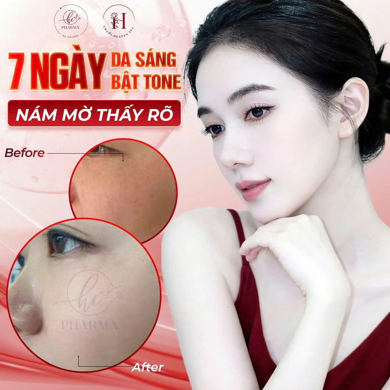 Poster giải pháp làm sáng da, hỗ trợ mờ nám của HC Pharma