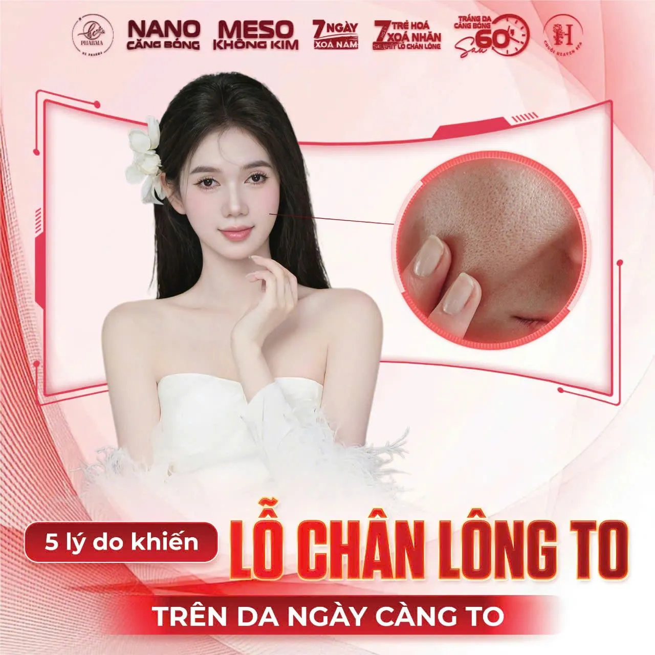 Poster giải thích 5 lý do khiến lỗ chân lông ngày càng to
