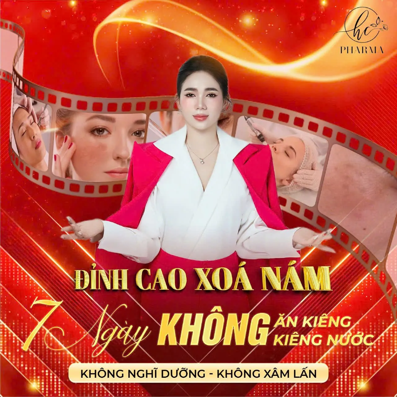 Poster phác đồ điều trị nám không ăn kiêng, không kiêng nước của HC Pharma