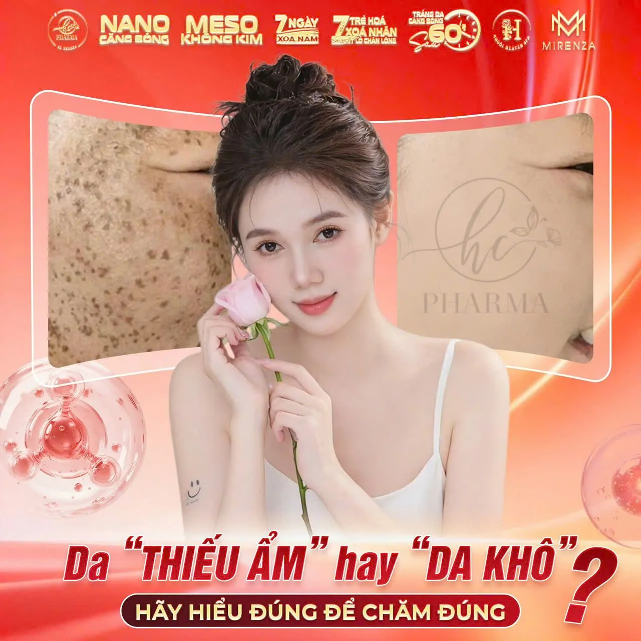 Poster kiến thức chăm sóc da thiếu ẩm của HC Pharma