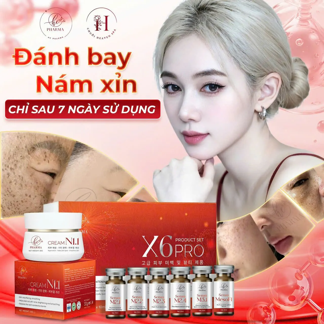 Bộ X6 Pro và kem dưỡng của HC Pharma hỗ trợ cải thiện nám xỉn