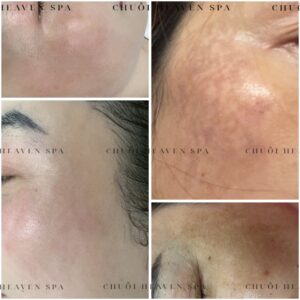 z7352146662007_fe6989d776de50a8f255fe6f3eebde67