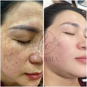 z7352155110498_d35fbf5d237e505d7dca9b8e747150cf