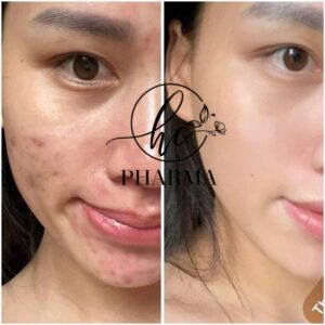 z7352155153993_4aa2019e561773e6aa4108c55bf250ec