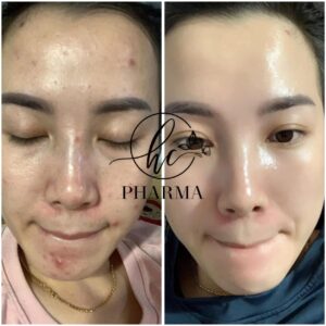 z7352155163679_0936b2c2f3b675533773140833b4f9f7