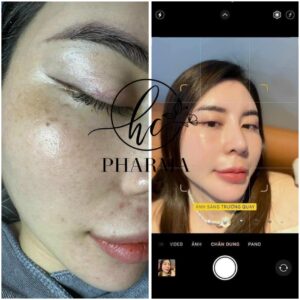 z7352155170886_081fcd3cf376367957055b44790f6a77