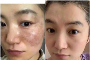 z7352155224519_6d1bca4f4cf24e86b26bc2bbd7c5d9b4