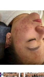 z7352403934778_afe935a6b2775ee7d4bcb39c50447619