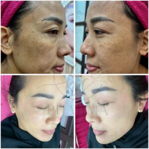 z7352407377810_2f3ca3ec8ae64fbaed36cf262bdb2f41