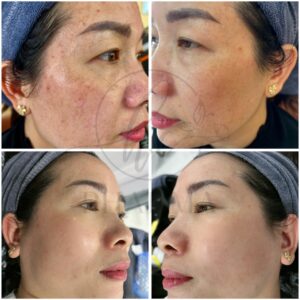 z7352407382456_f901dced2d87fceb943b3b5121356dd6