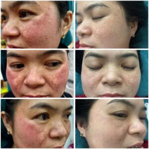 z7352407404654_e305a63ac7a6cb52b1b12c4ea80a2e35