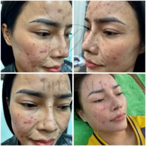 z7352407412520_6cc516038c6c3f2c86c6593609ee2e33