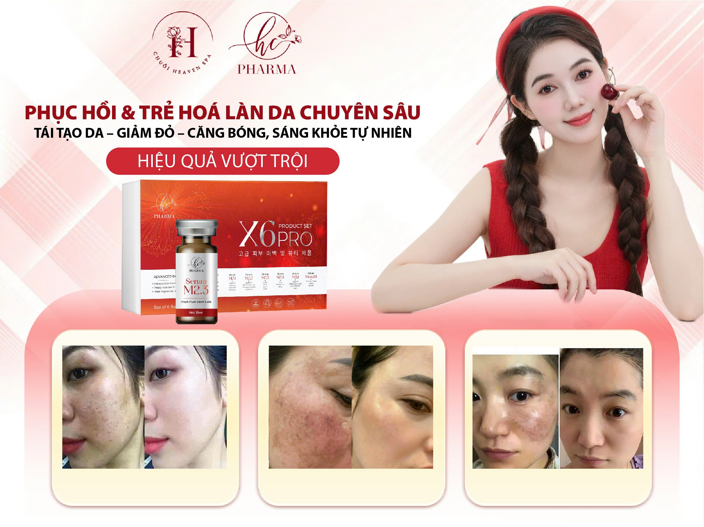 SERUM M2.3 10ML - Ảnh 3
