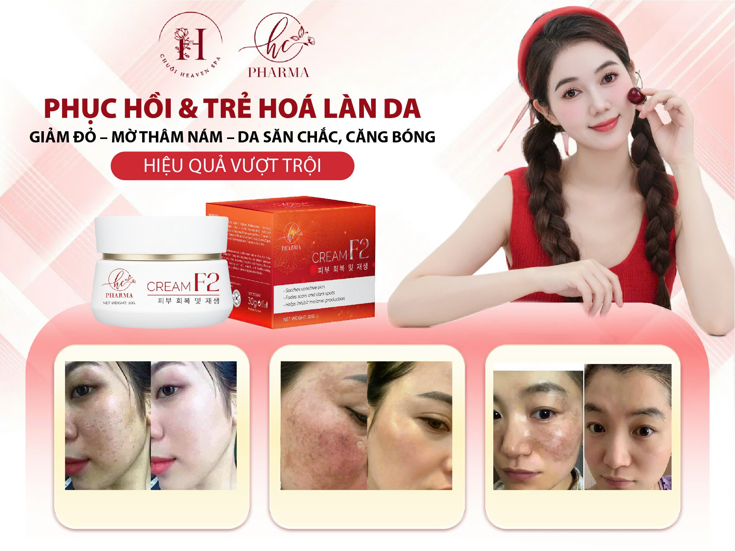 KEM F2 30ML - Ảnh 3